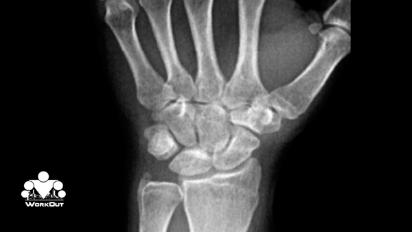 Стойка на руках: 5 ошибок новичков Стойка на руках: 5 ошибок новичков